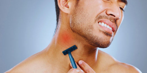 How to Prevent Razor Burn